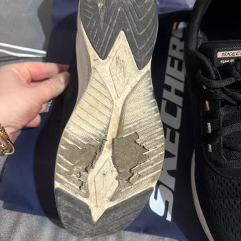 My Skechers Shoes Tore in Just 2 Months – Denied Warranty Claim