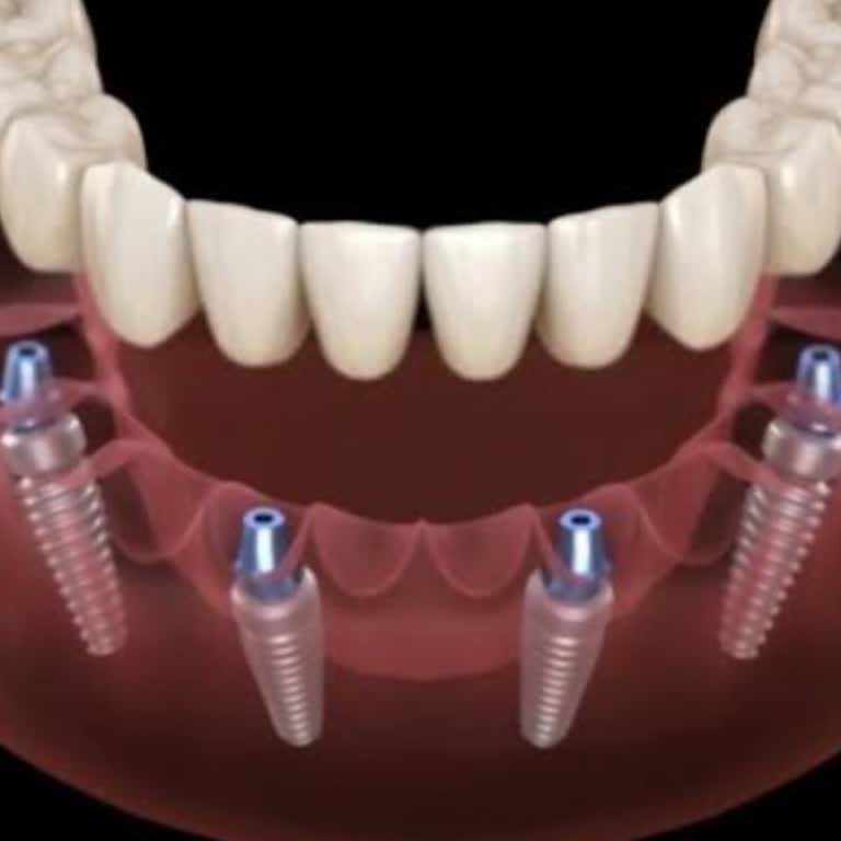 Diş Tedavisinde Uzayan Süreç