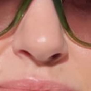 Op. Dr. Onur Tüylü'ye Burun Ameliyatı Oldum, Pişmanım!