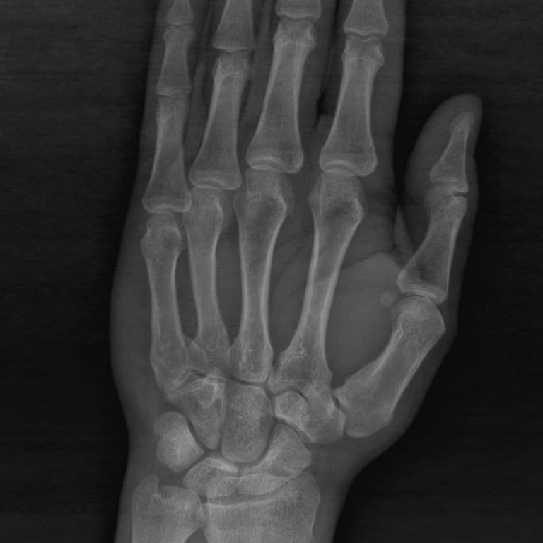 Türk Silahlı Kuvvetleri Askerlikte Yaşanan Sağlık Sorunu ve Sonrası Mağduriyet