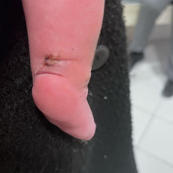 Bebeğimin Tedavisindeki Hatalar Ve Yanlış Yönlendirmeler