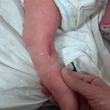 Bebeğimin Tedavisindeki Hatalar Ve Yanlış Yönlendirmeler