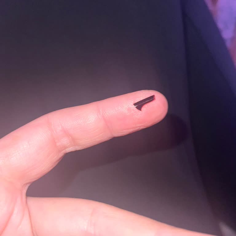 Eti Browni Classic'ten Çıkan Plastik Parça Tehlikesi