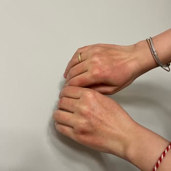 Sahte Ürünle Cilt Tahribatı: Mustela Stelatopia+ Tehlikesi