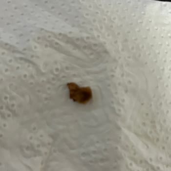 Tadelle Çikolatada Sert Parça Şoku