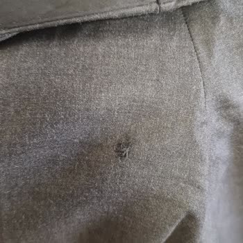 Boyner'den Alınan Takım Elbisenin Kalite Sorunu Ve Müşteri Memnuniyetsizliği