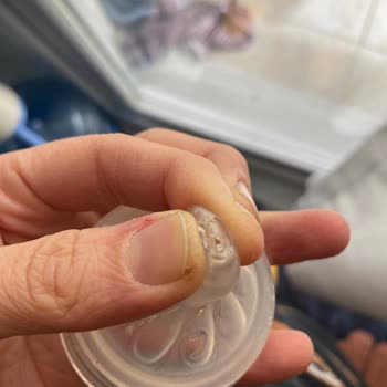 Philips Avent Biberon Uçları Yırtık Çıktı