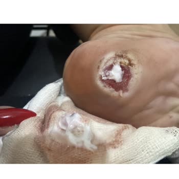 Yanlış Tedavi Sonrası Devam Eden Ağrı Ve Mağduriyet