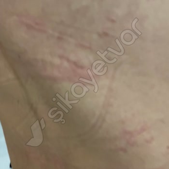 Snickers me causó problemas de salud, solicito asistencia