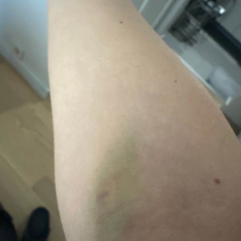 Lösante Hastanesi'nde İletişim Ve Hizmet Sorunları