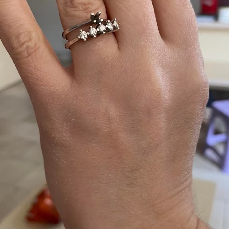 Garanti Kapsamındaki Yüzüğümdeki Taş Düşmesi Ve Ek Ücret Talebi