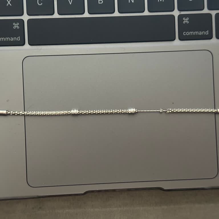 Pandora'nın Yetersiz Müşteri Hizmetleri Ve Garanti Süreci