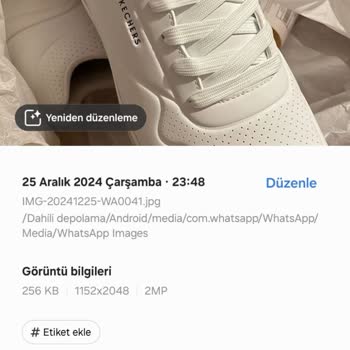 Skechers Ayakkabıda Hızlı Aşınma Ve Müşteri Hizmetleri Sorunu