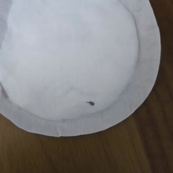 Hijyen Sorunu: Göğüs Pedinde Böcek Ölüleri