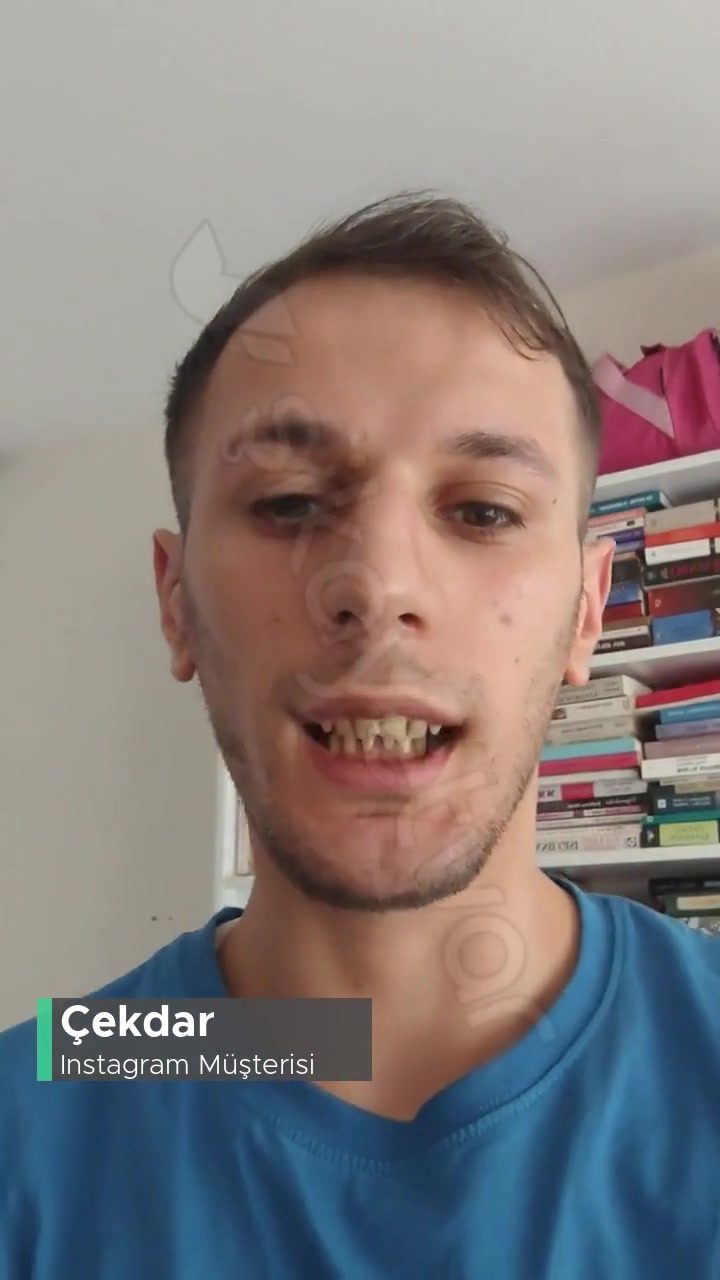 Instagram Hesabım Kapandı! videonun kapak resmi