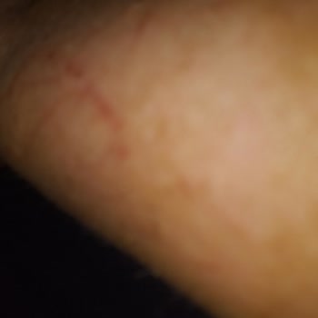 Sağlık Bakanlığı İlaçlar Fayda Etmiyor!