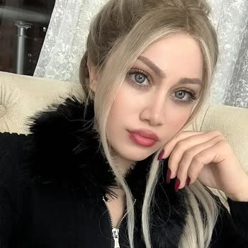 Yanlış Renk Lens Ve Kötü Müşteri Hizmeti Deneyimi