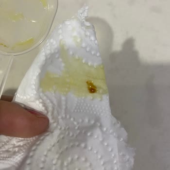 Argivit Smart Ürünü Bozuk Çıktı: Kötü Koku Ve Siyah Kalıntılar