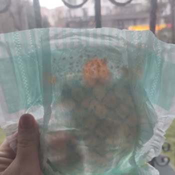 Bozuk Prima Bezleri Ve İade Sorunları