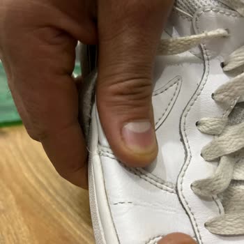 Deichmann'dan Alınan Ayakkabı 6 Ay Dolmadan Patladı