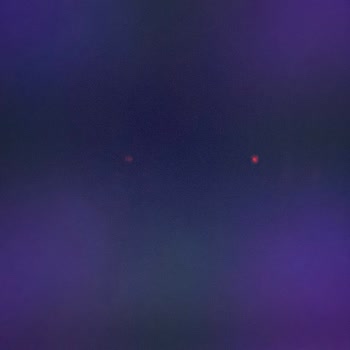 Onvo A101'den Aldığım Ürün İçin Cevap Beklerken Sabır Tükeniyor!