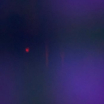 Onvo A101'den Aldığım Ürün İçin Cevap Beklerken Sabır Tükeniyor!