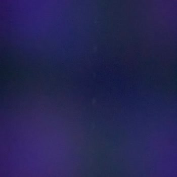 Onvo A101'den Aldığım Ürün İçin Cevap Beklerken Sabır Tükeniyor!