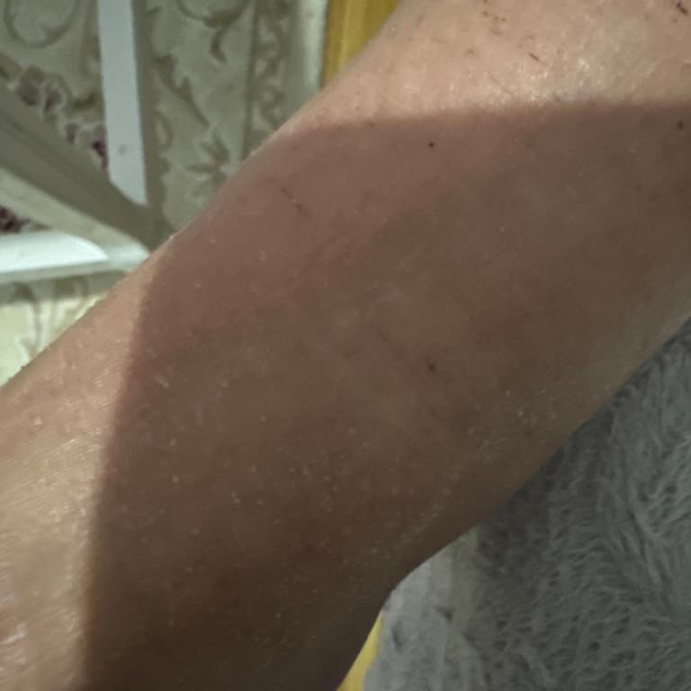 Ayak Maskesi Sonrası Kızarıklık Ve Kaşıntı Sorunu