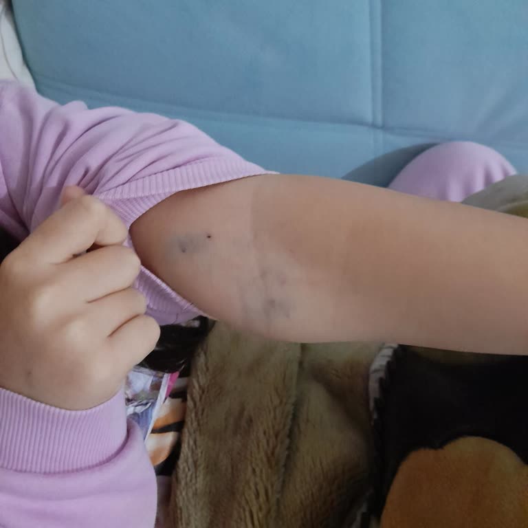 Kocaeli Derince Araştırma Hastanesi Acil Serviste Yetersiz Hemşirelik Hizmeti