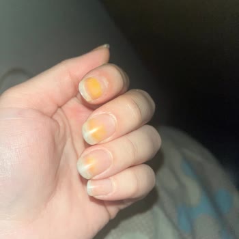 Flormar Oje Sonrası Tırnaklarda Kalıcı Lekeler