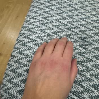 Mutfak Temizleyici Ellerimi Yara Yaptı!