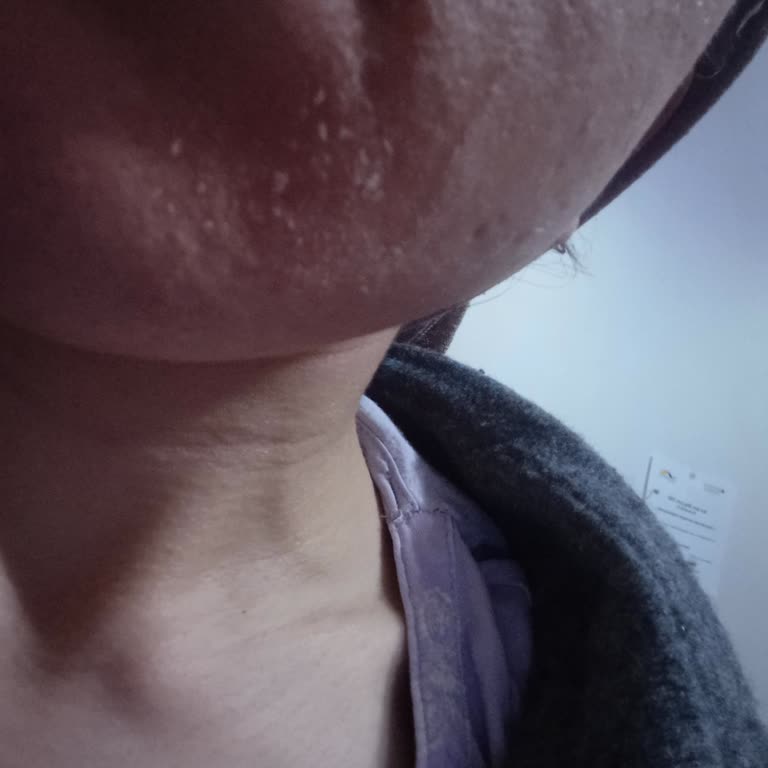 Effaclar Duo Serisi Cilt Sorunlarına Neden Oldu