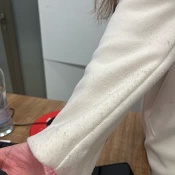 Stradivarius'tan Aldığım Kabanın Kalitesizliği