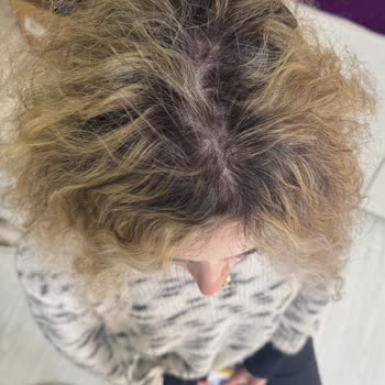 Kuaför Faciası: Saçlarım Yandı Ve Telafi Edilmedi