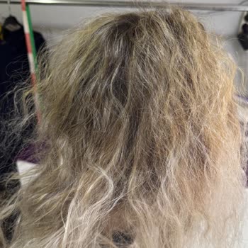 Kuaför Faciası: Saçlarım Yandı Ve Telafi Edilmedi