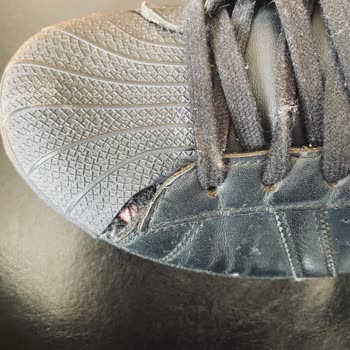 Adidas Ayakkabılarında Sürekli Yırtılma Sorunu