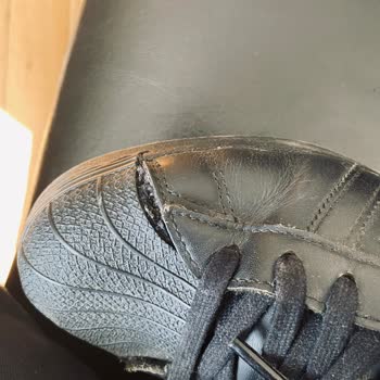 Adidas Ayakkabılarında Sürekli Yırtılma Sorunu