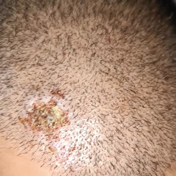 Batman Hayat Saç Ekim Merkezi Şikayeti