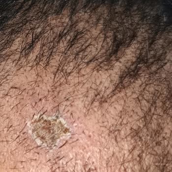 Batman Hayat Saç Ekim Merkezi Şikayeti