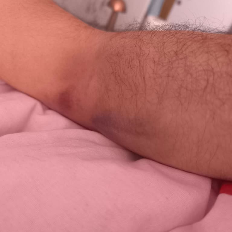 Pursaklar Devlet Hastanesi Kan Alma İşleminde Yaşanan Sorunlar!