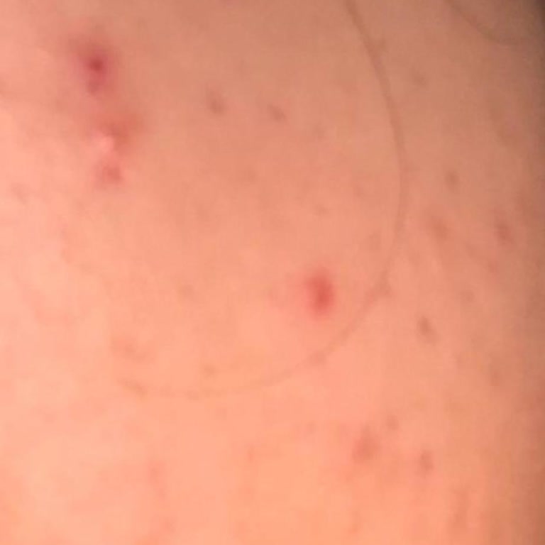 Hakan Eczanesi (Sivas) Tarafından Mağdur Edildim!