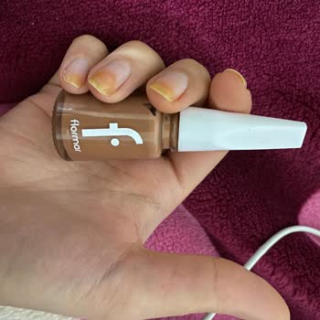 Flormar Oje Sonrası Kalıcı Sarılık Sorunu