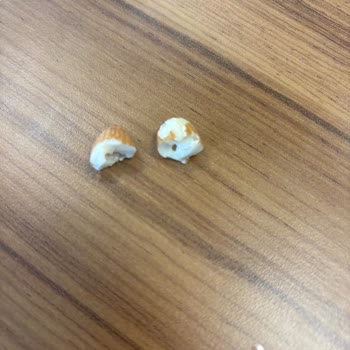 Çiğ Bademde İstenmeyen Sürprizler