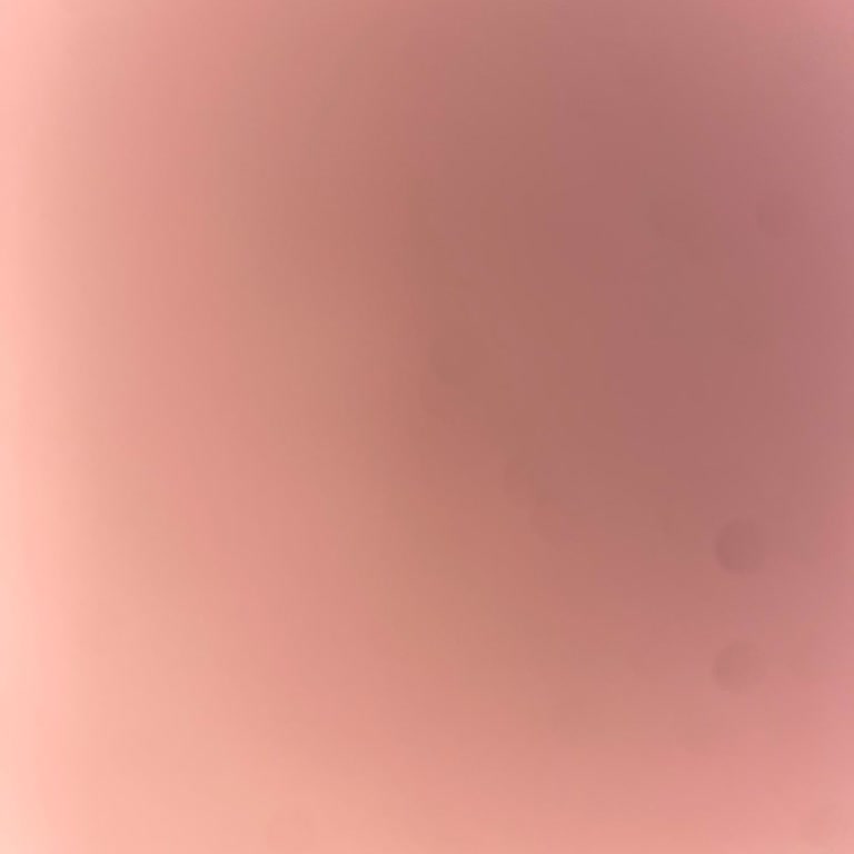 Yatakta Çökme Ve İlgisizlik Sorunu