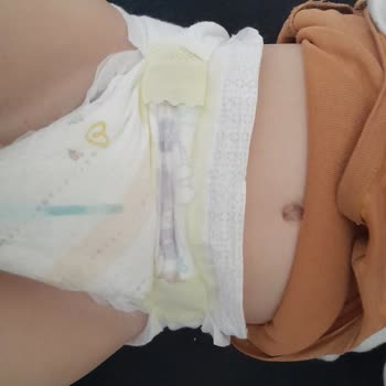 Prima Premium Care 6 Numara Bezde Sızıntı Sorunu