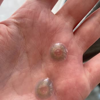 Lens Kalitesi Ve Müşteri Hizmeti Sorunu