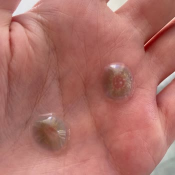 Lens Kalitesi Ve Müşteri Hizmeti Sorunu