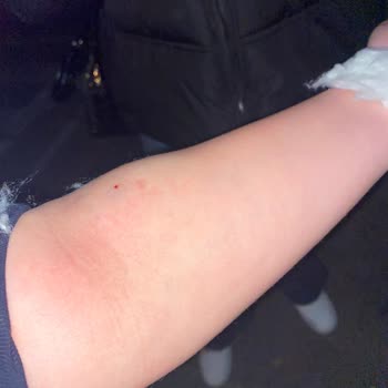 Hastanede Damar Yolu Açma Sorunu Ve İlgisizlik