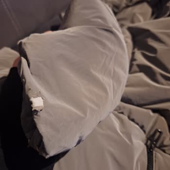 Mavi Mont Kalitesizliği: Soyulma Sorunu Ve Yetersiz Müşteri Hizmeti