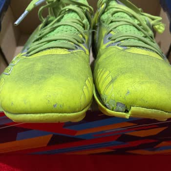 Lescon Krampon Kalitesizliği Ve İlgisiz Mağaza Deneyimi